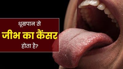 क्या धूम्रपान करने से जीभ का कैंसर होता है? एक्‍सपर्ट से जानें इसके लक्षण 