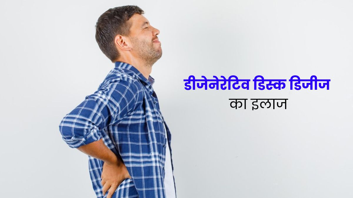 डीजेनेरेटिव डिस्क डिजीज का इलाज कैसे होता है? जानें डॉक्टर से