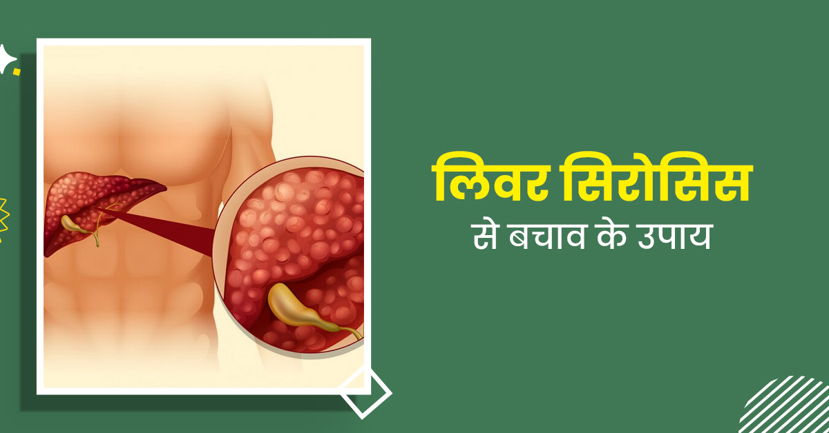 Liver Cirrhosis: लिवर सिरोसिस से बचने के लिए अपनाएं ये 5 उपाय 