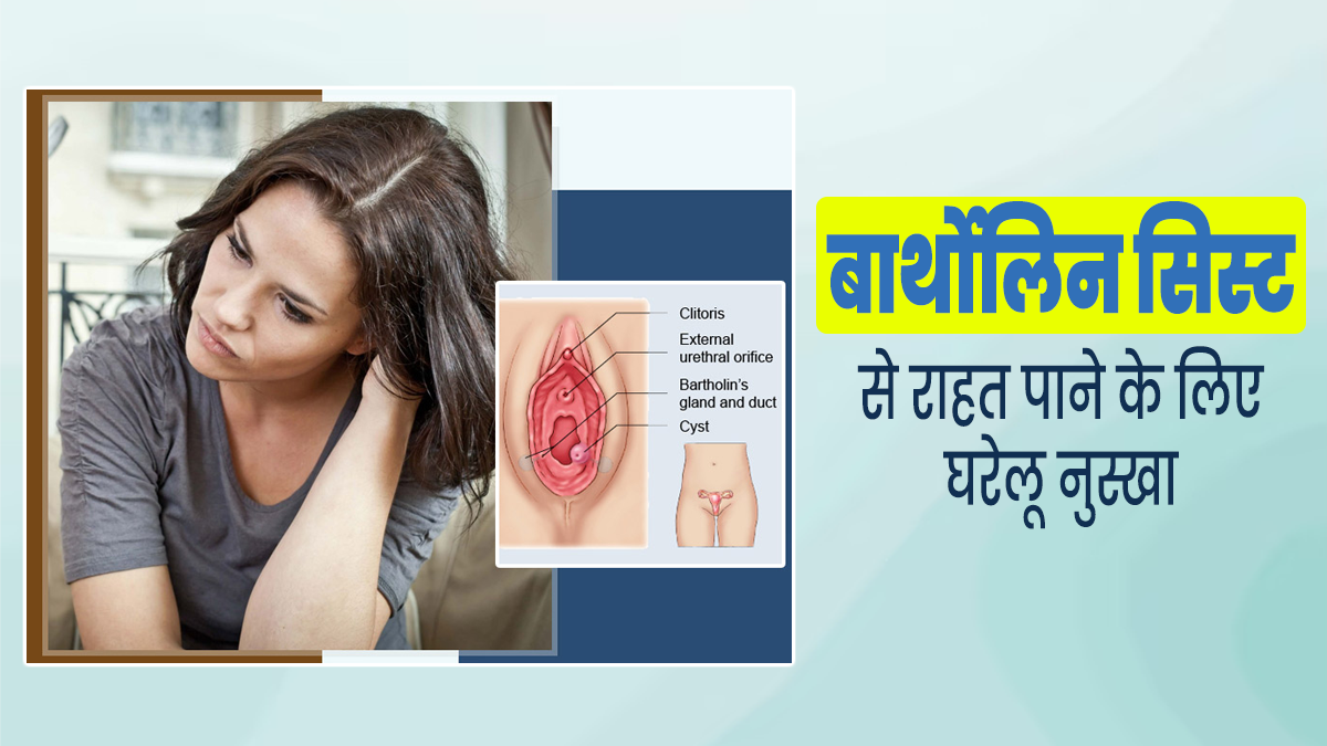 बार्थोलिन सिस्ट (योनि के पास गांठ) से राहत पाने के लिए अपनाएं ये एक खास घरेलू नुस्खा, एक्सपर्ट से जानें  