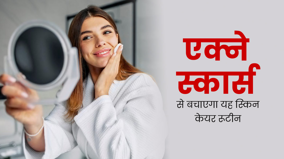 Acne Scars: मुंहासों के न‍िशान से बचने के ल‍िए फॉलो करें यह स्‍क‍िन केयर रूटीन, मिलेगी बेदाग त्‍वचा 