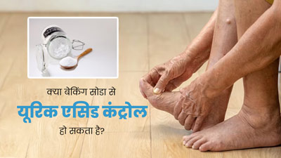 बेकिंग सोडा से कंट्रोल हो सकता है यूरिक एसिड, एक्सपर्ट से जानें सेवन का सही तरीका