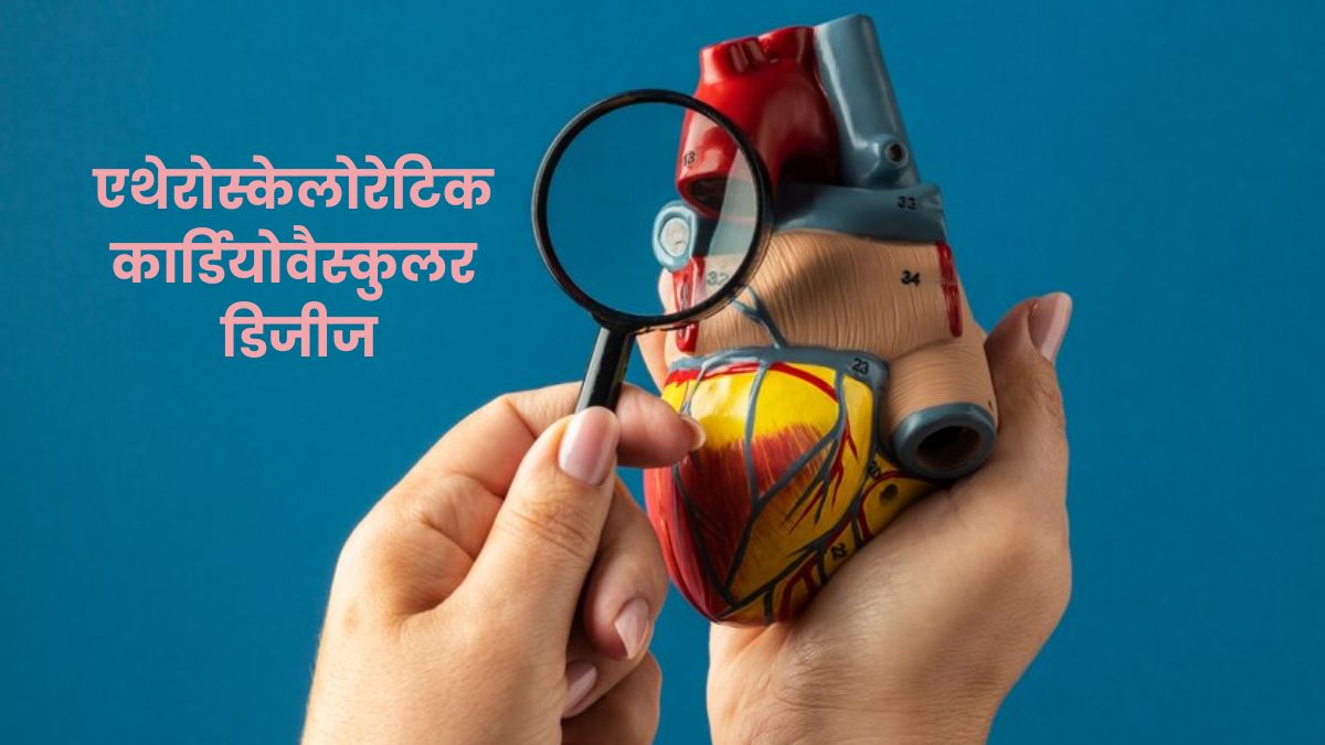 एथेरोस्केलोरेटिक कार्डियोवैस्कुलर डिजीज क्या है? जानें लक्षण और बचाव