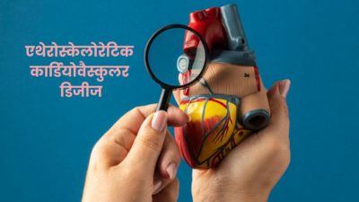 एथेरोस्केलोरेटिक कार्डियोवैस्कुलर डिजीज क्या है? जानें लक्षण और बचाव