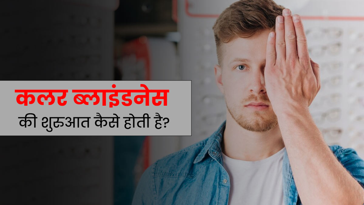 कलर ब्लाइंडनेस (रंगों की पहचान न कर पाना) की समस्या कैसे शुरू होती है? डॉक्टर से समझें