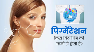 शरीर में इन 4 पोषक तत्वों की कमी से हो सकती है पिग्मेंटेशन की समस्या, जानें इनके बेस्ट सोर्स