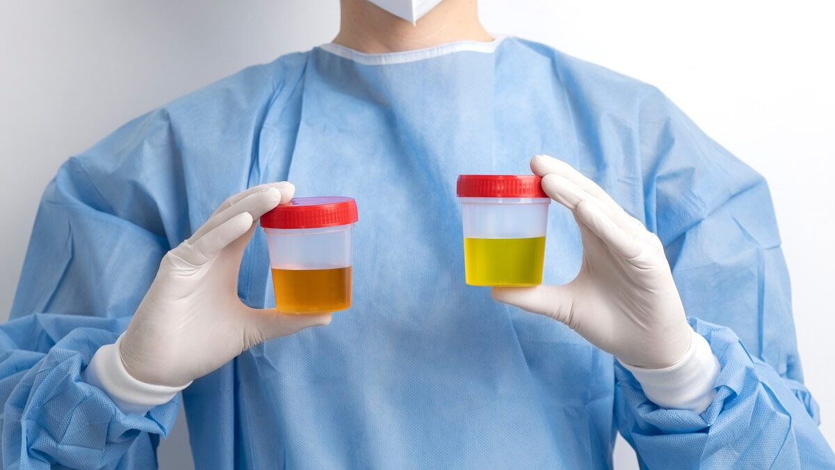 urine culture test in pregnancy 
