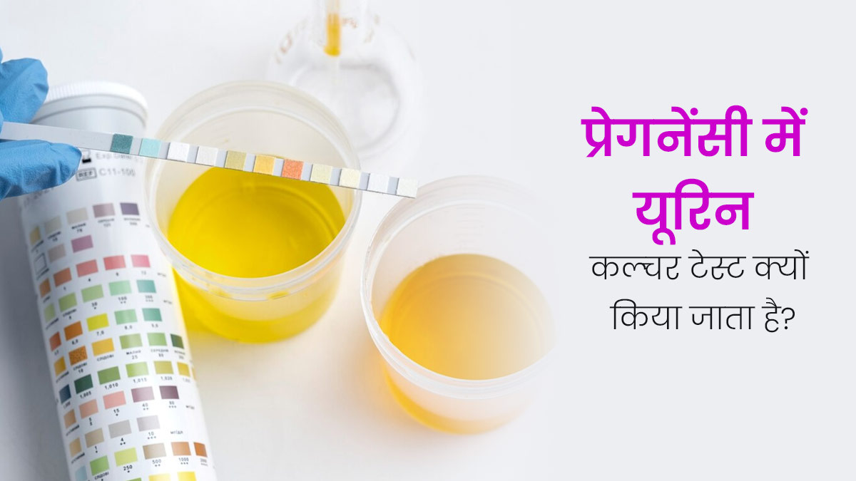 प्रेग्नेंसी में यूरिन कल्चर टेस्ट क्यों किया जाता है? डॉक्टर से जानें कब पड़ती है इसकी जरूरत