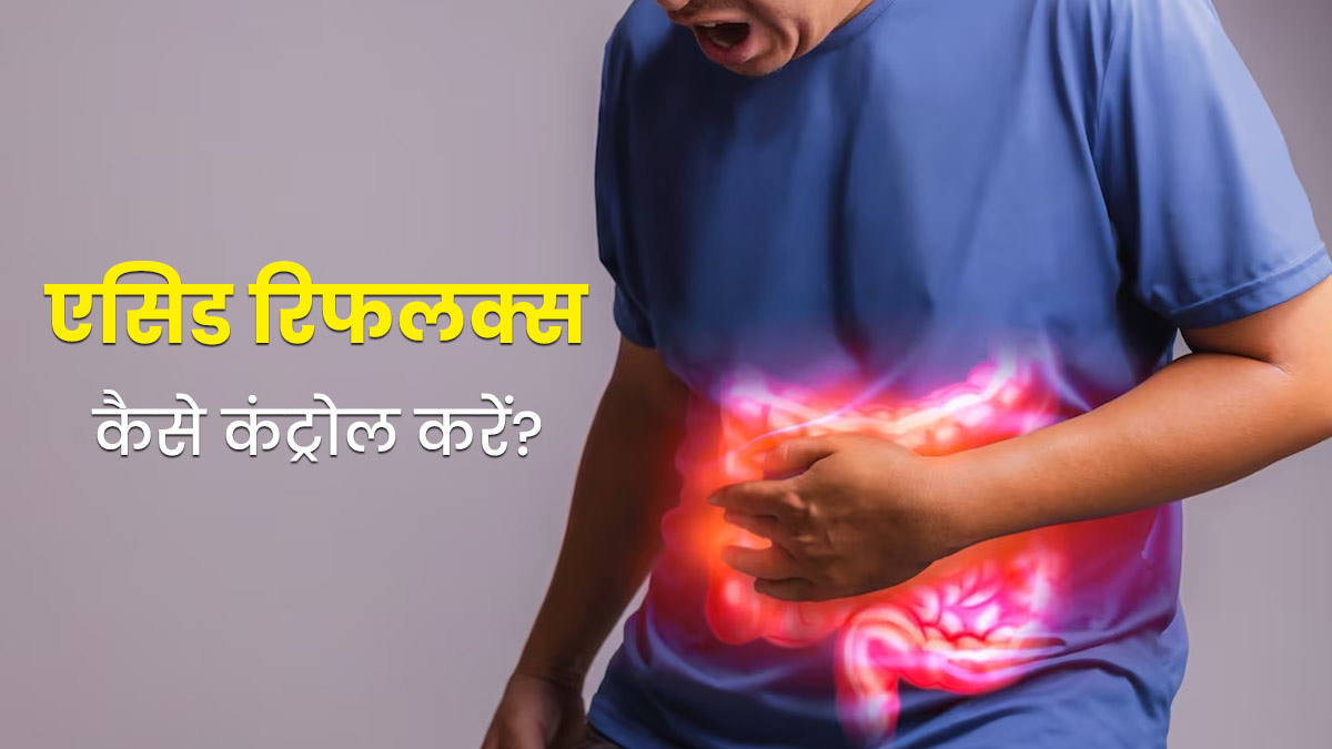 एसिड रिफलक्स को कंट्रोल करने के लिए क्या करें? डॉक्टर से जानें उपाय