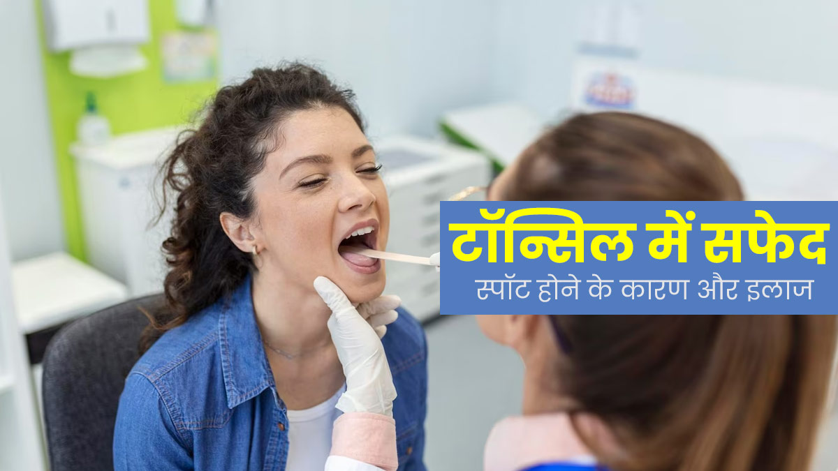 टॉन्सिल में सफेद स्पॉट क्यों दिखाई देते हैं, जानें इसके कारण और इलाज का तरीका