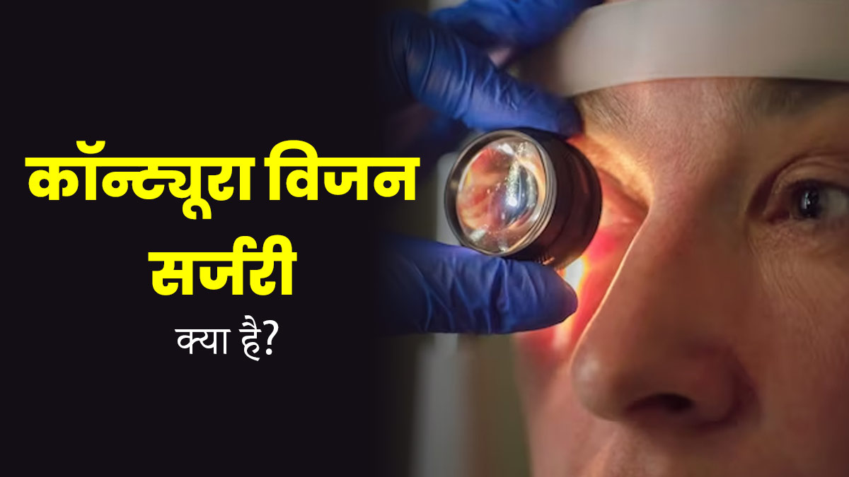 कॉन्ट्रा विजन सर्जरी क्या होती है? जानें आंखों की किन समस्याओं में किया जाता है इसका इस्तेमाल