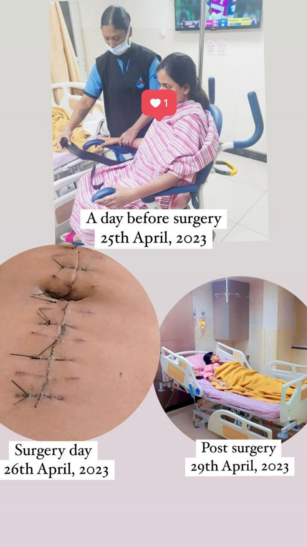 surgery