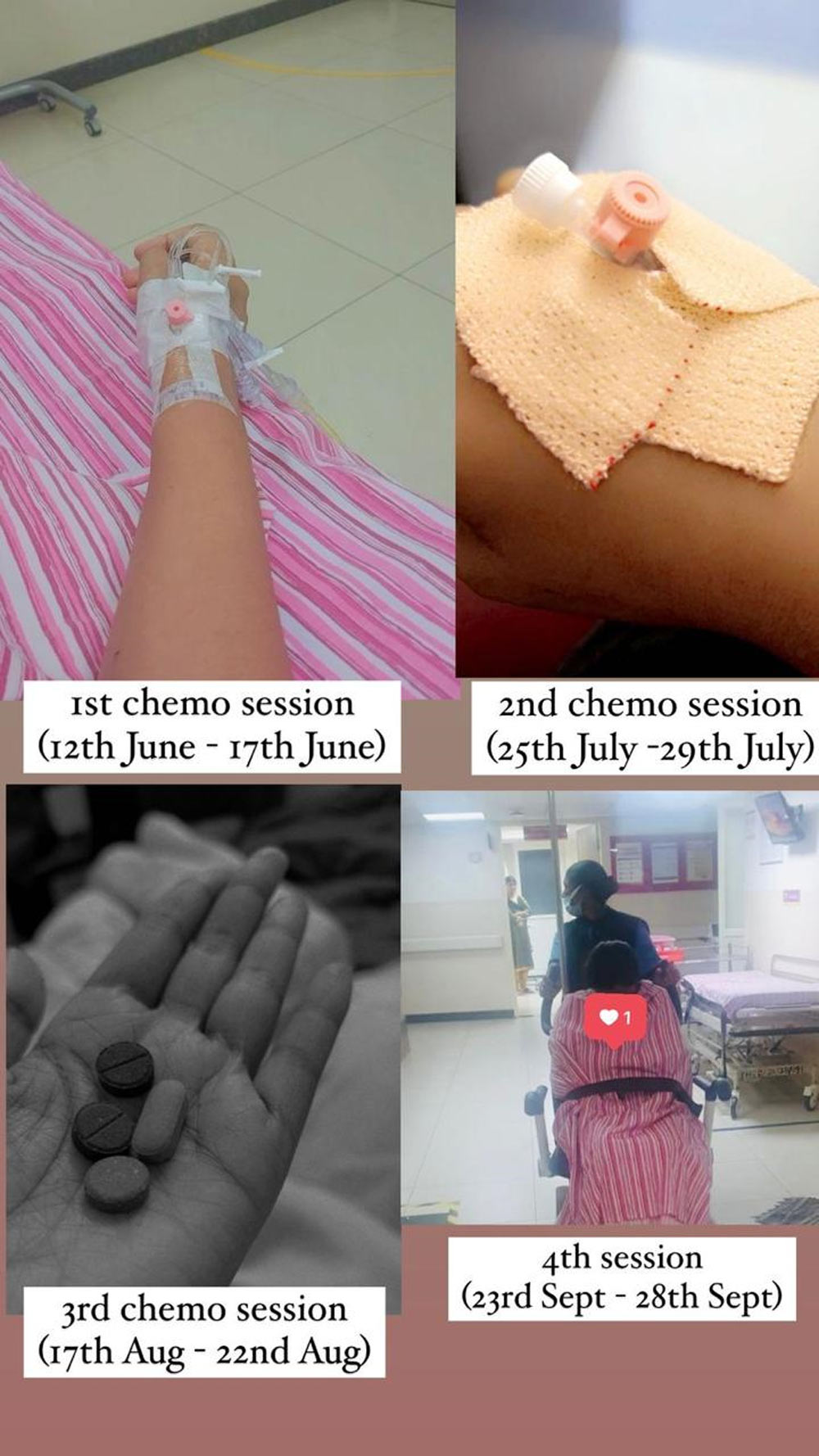 chemo