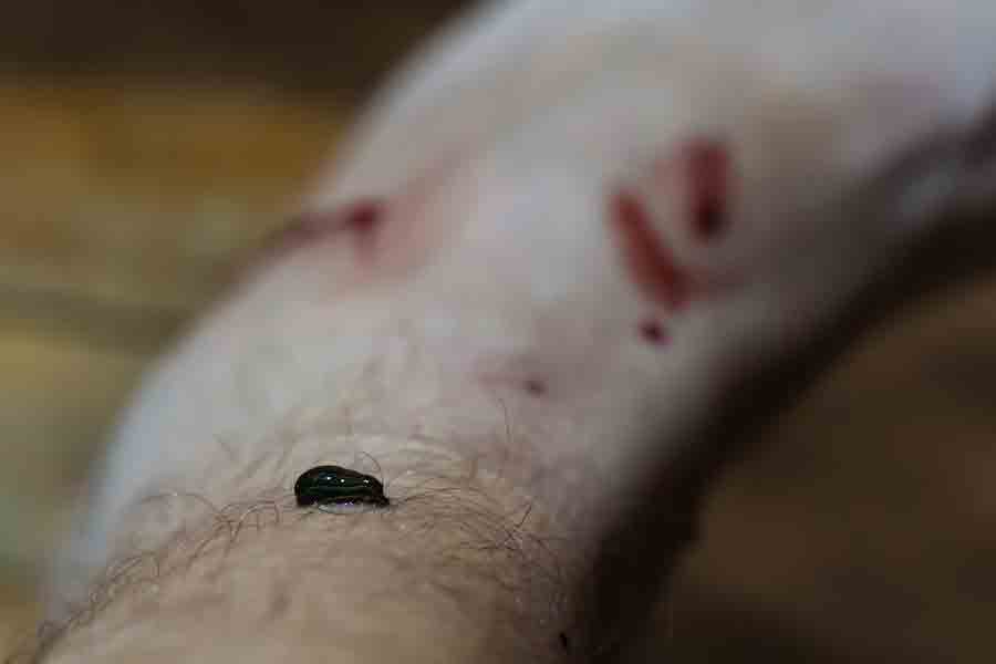 raktamoshana therapy benefits in hindi