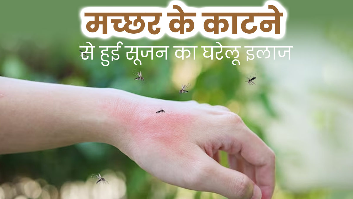 मच्छर के काटने से त्वचा में दिख रही है सूजन और लाल निशान? अपनाएं ये 5 घरेलू उपाय 