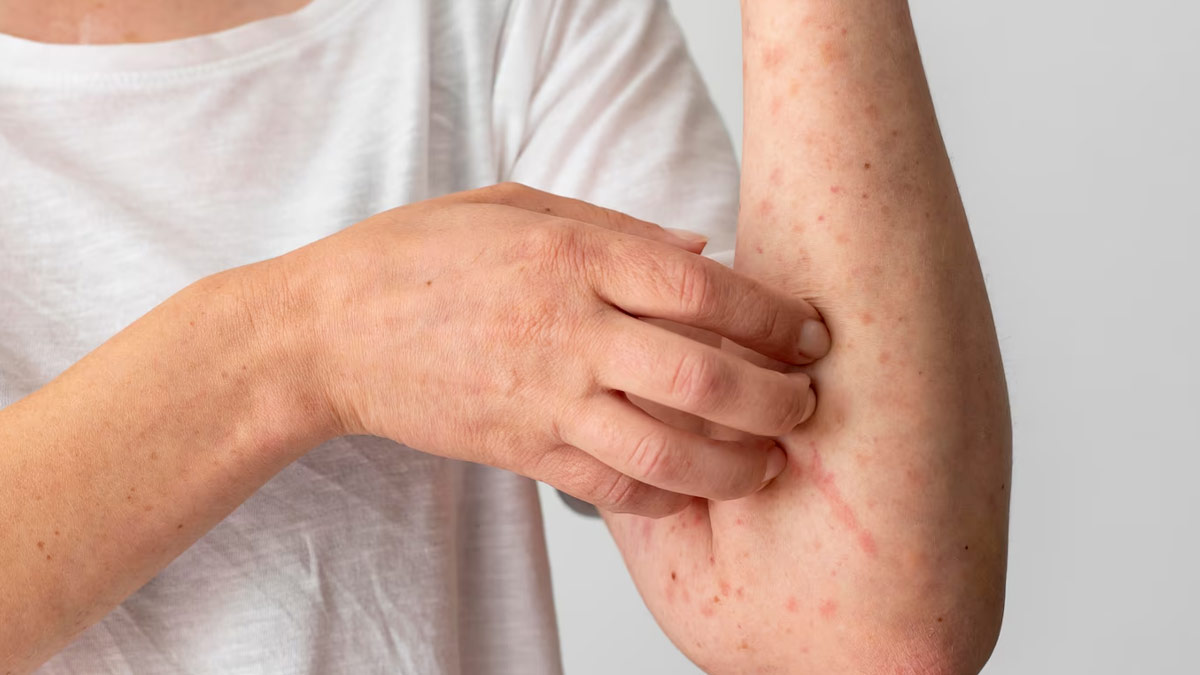 skin rashes and skin itching 