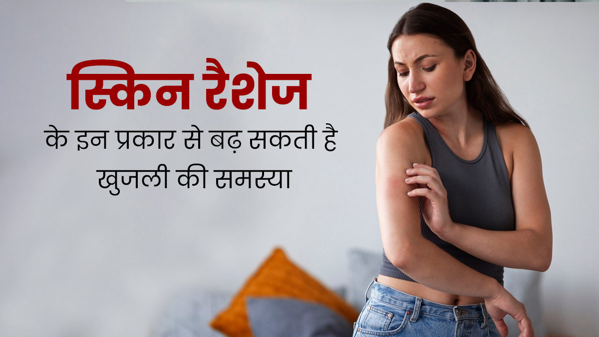 इन 4 तरह की स्किन रैशेज की वजह से त्वचा पर हो सकती है खुजली की समस्या, इस तरह से करें बचाव