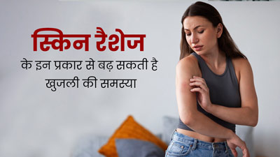 इन 4 तरह की स्किन रैशेज की वजह से त्वचा पर हो सकती है खुजली की समस्या, इस तरह से करें बचाव