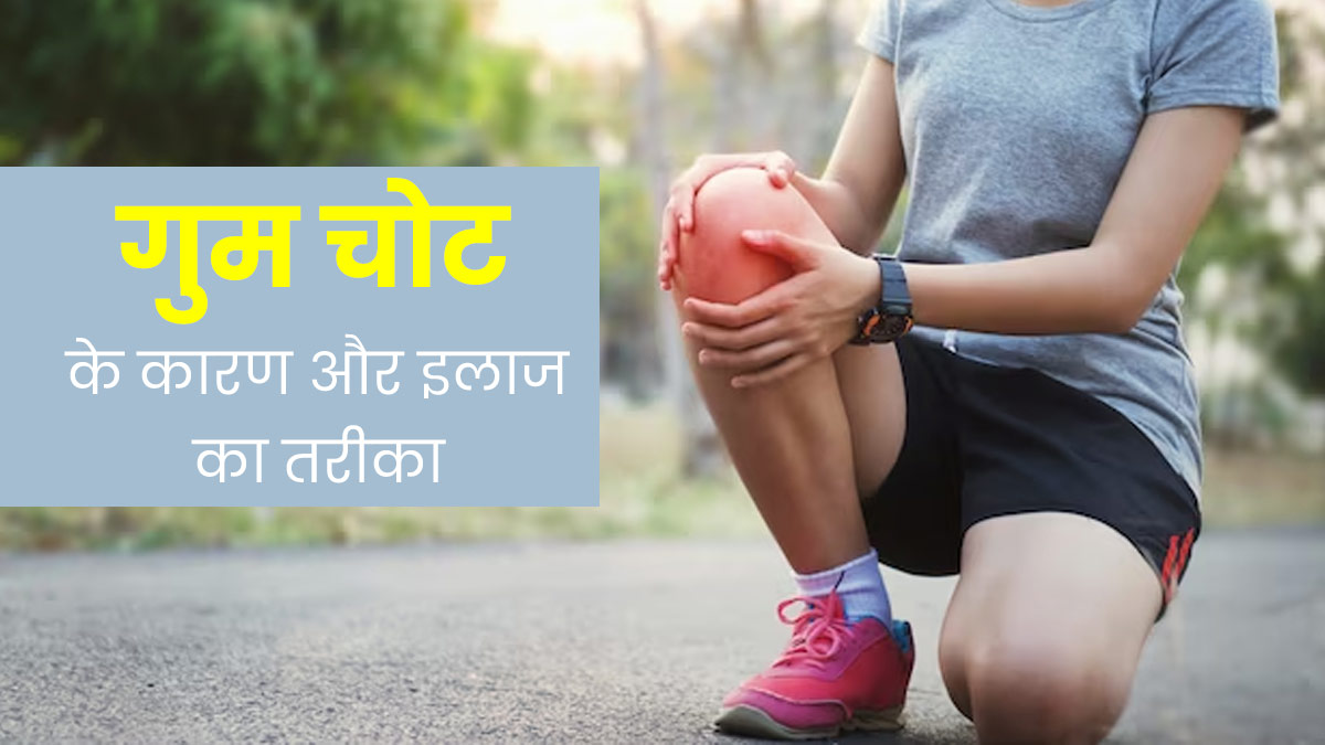 गुम चोट क्या होती है? जानें इसके कारण और इलाज