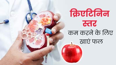 Creatinine Level: क्रिएटिनिन स्तर कम करने के लिए खाएं ये 5 फल, मिलेगा लाभ