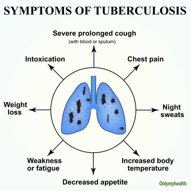 World Tuberculosis Day 2024 Expert Shares The Link Between Regular   2 Tb 