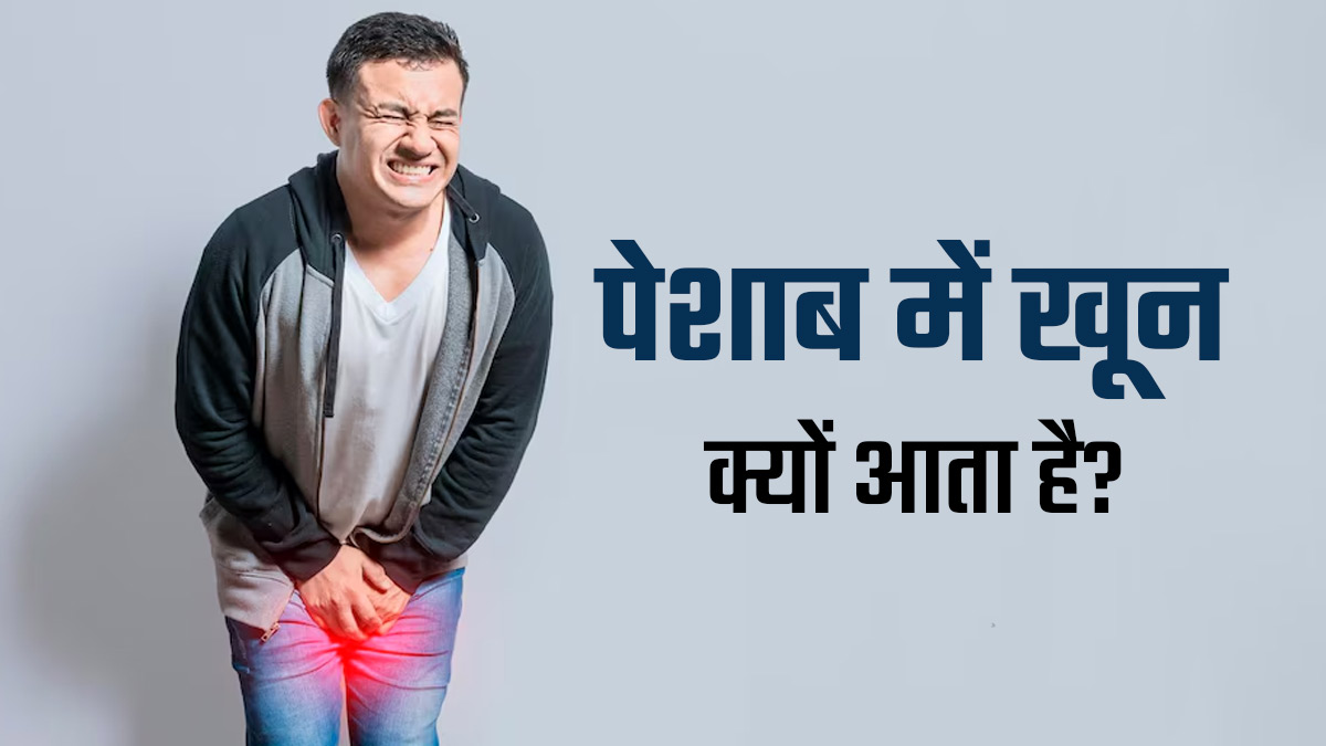 Blood in Urine: पेशाब में खून क्यों आता है? डॉक्टर से जानें 3 कारण