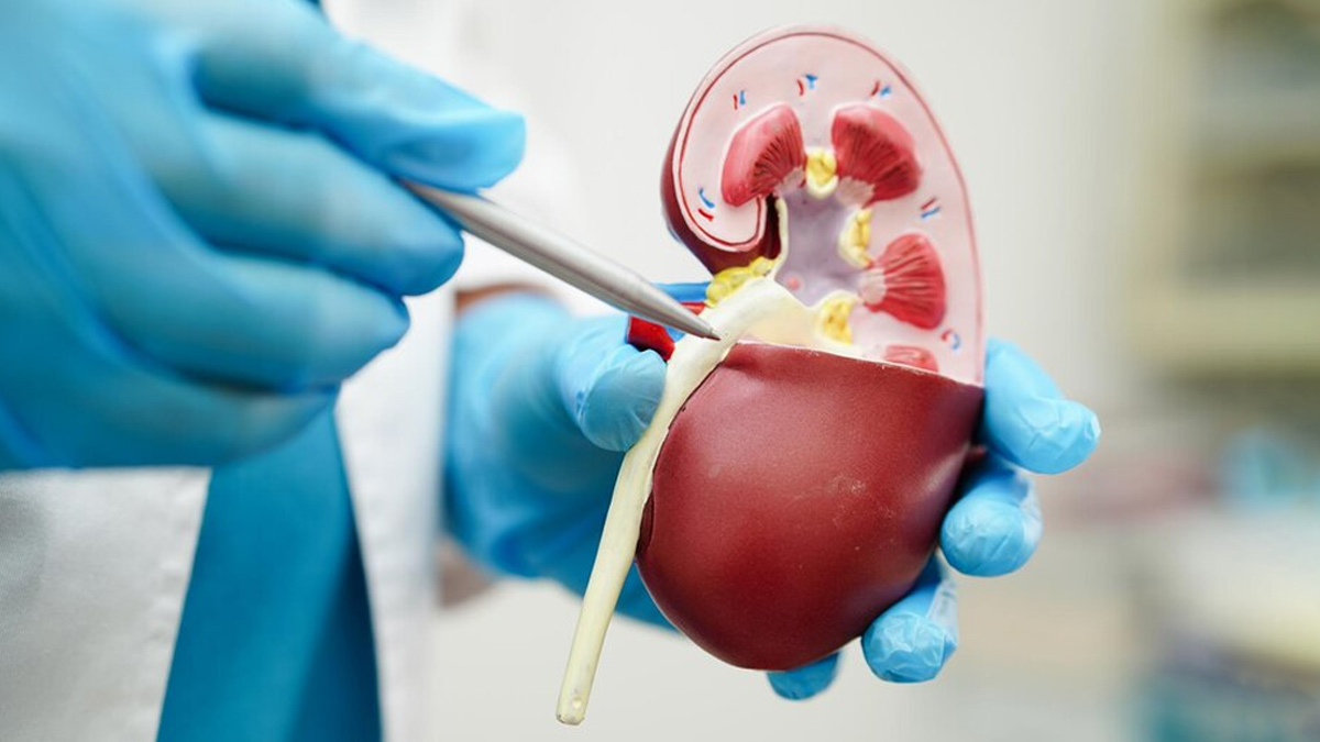 kidney-disease