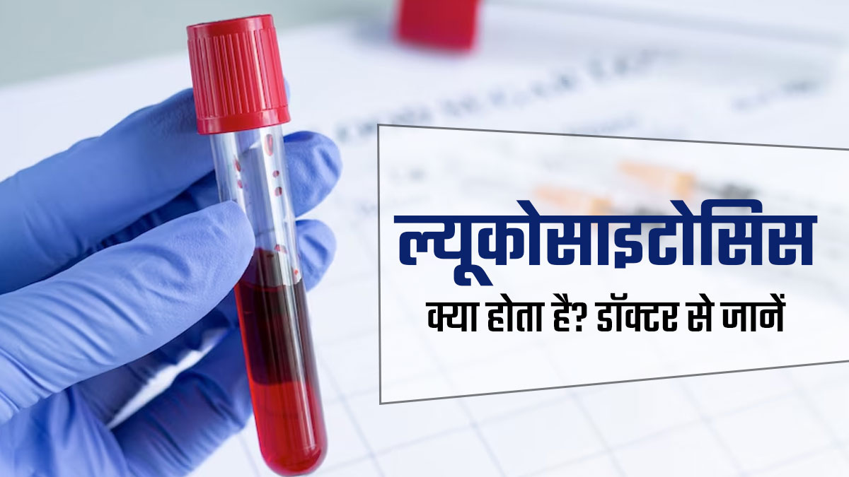 ल्यूकोसाइटोसिस क्या होता है? डॉक्टर से जानें शरीर में कैसे शुरू होती है यह समस्या