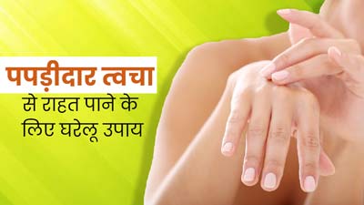 पपड़ीदार त्वचा से छुटकारा पाने के लिए अपनाएं ये 5 घरेलू उपाय