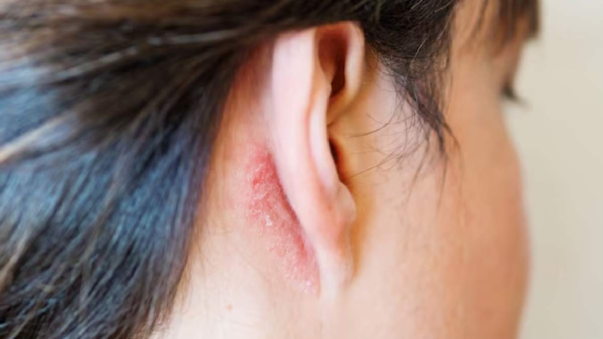 Troubled With Itchy Ear? Here Are 7 Reasons Of Itchy Ears And How To ...