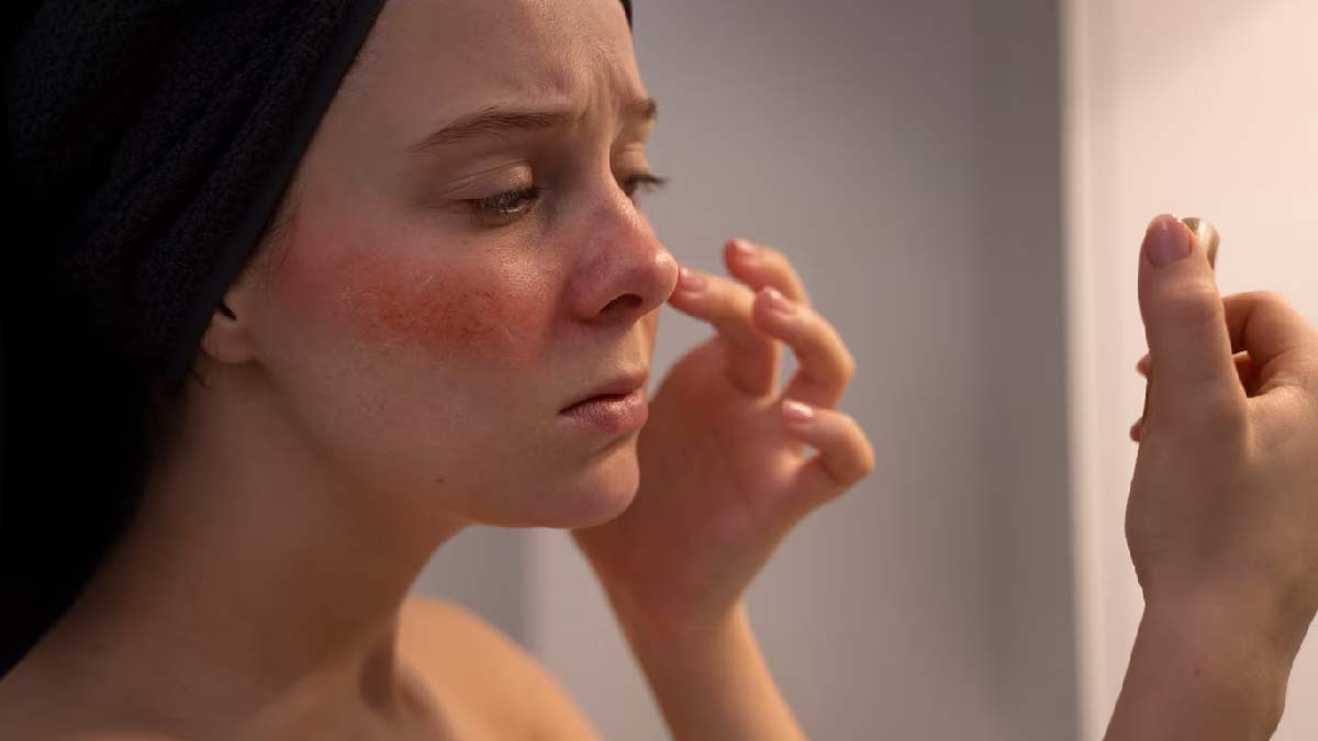 pregnancy rashes home remedies