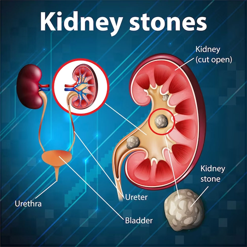 kidney