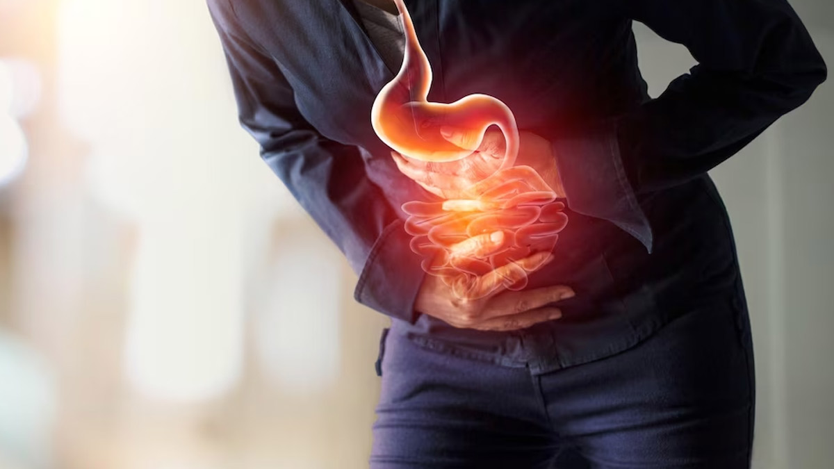 Study Suggests IBD Symptoms May Appear Years Before A Clinical Diagnosis: How To Recognise Them Early?