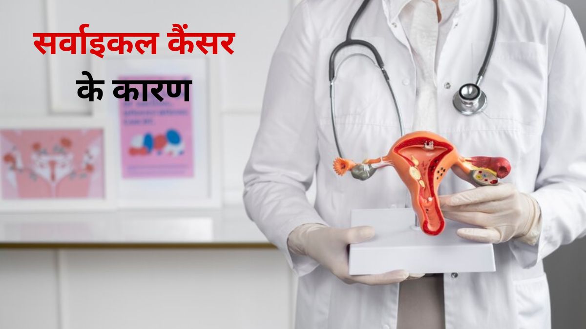 किन लोगों को सर्वाइकल कैंसर का खतरा ज्यादा रहता है? जानें डॉक्टर से