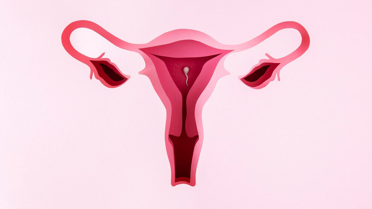 cervical cancer