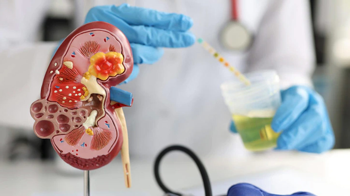 World Kidney Day: What Are The Preventive Measures Of Chronic Kidney Diseases? Expert Explains