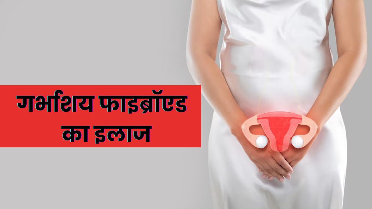 गर्भाशय फाइब्रॉएड का इलाज कैसे होता है? जानें जरूरी सावधानियां