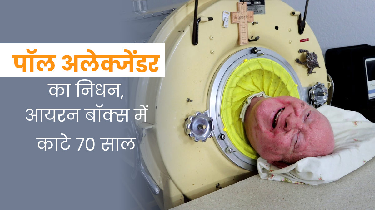 आयरन लंग के जरिए जिंदा रहने वाले पॉल अलेक्जेंडर का निधन, लोहे के फेफड़ों के अंदर गुजारे 70 साल