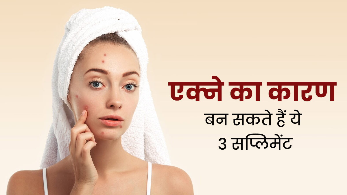 आप भी खाते हैं ये 3 सप्लीमेंट्स तो हो सकती है एक्ने की समस्या, जानें इनके बारे में