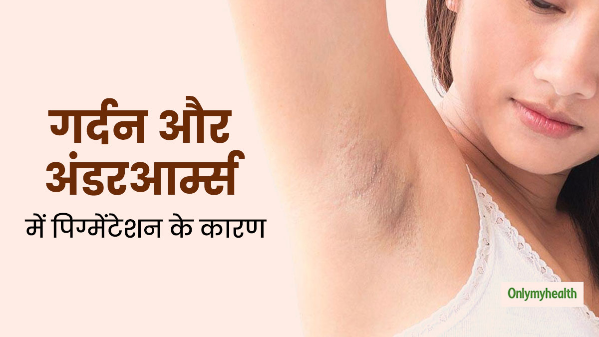 गर्दन और अंडरआर्म्स में पिग्मेंटेशन का कारण हो सकती हैं ये स्वास्थ्य समस्याएं, डॉक्टर से जानें