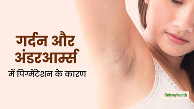 गर्दन और अंडरआर्म्स में पिग्मेंटेशन का कारण हो सकती हैं ये स्वास्थ्य समस्याएं, डॉक्टर से जानें