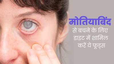 मोतियाबिंद से बचने के लिए डाइट में शामिल करें ये 5 फूड्स, कम होगा जोखिम 