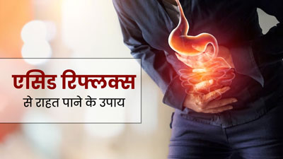एसिड रिफ्लक्स (एसिडिटी) से राहत पाने के लिए अपनाएं ये 5 घरेलू उपाय, मिलेगी जल्दी राहत