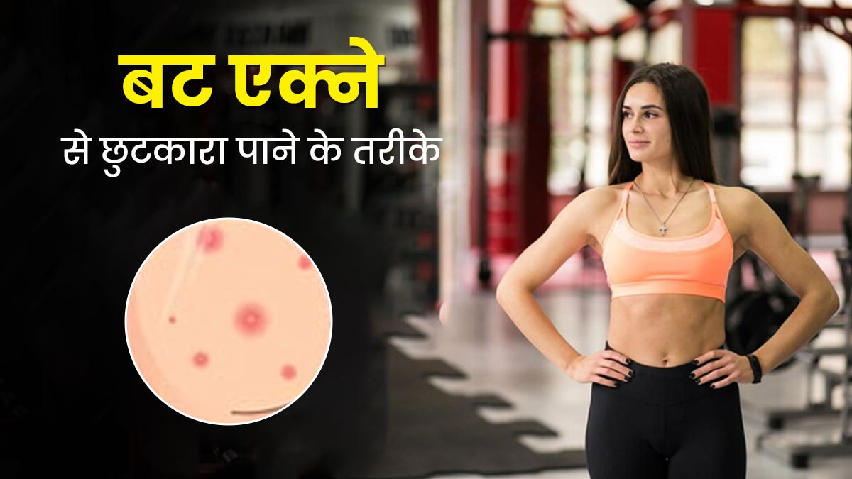 हिप्स पर हो गए हैं एक्ने तो आजमाएं ये कारगर टिप्स, दूर होगी समस्या