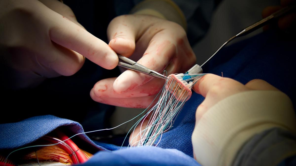 15 साल के बच्चे को थी हार्ट की समस्या, डॉक्टरों ने आर्टिफिशियल हार्ट लगाने के बजाय रिपेयर किया हार्ट वॉल्व
