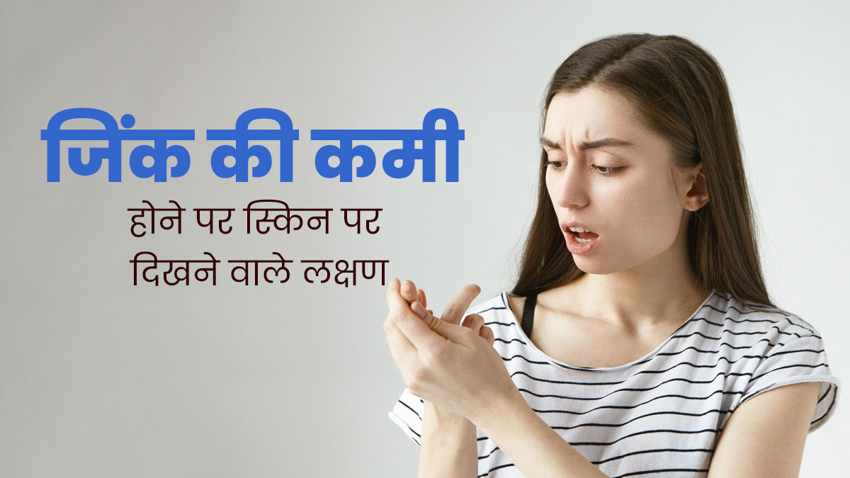 शरीर में जिंक की कमी होने पर स्किन पर दिखते हैं ये लक्षण, जानें बचाव