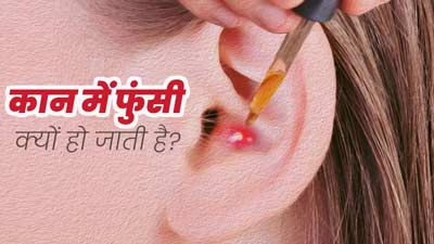 कान में फुंसी क्‍यों हो जाती है? डॉक्‍टर से जानें इसका कारण और इलाज 