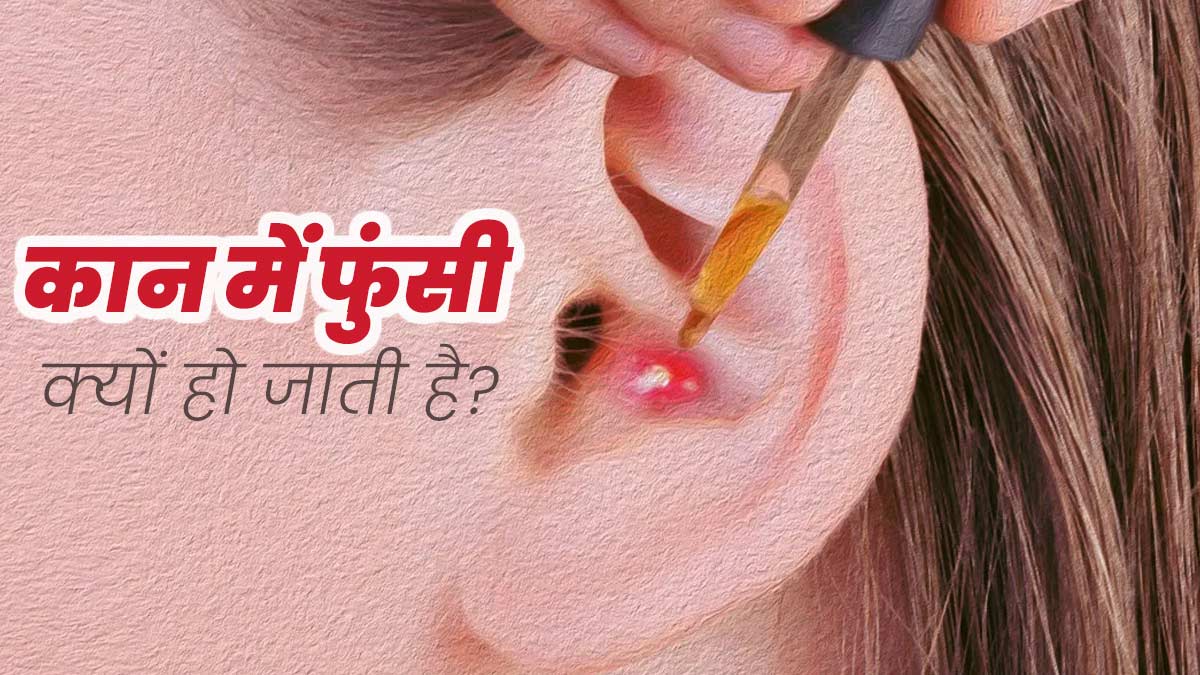 कान में फुंसी क्‍यों हो जाती है? डॉक्‍टर से जानें इसका कारण और इलाज 