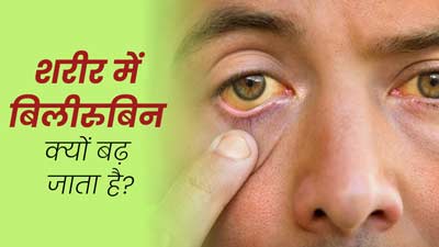 शरीर में बिलीरुबिन क्यों बढ़ जाता है? जानें कंट्रोल करने के टिप्स