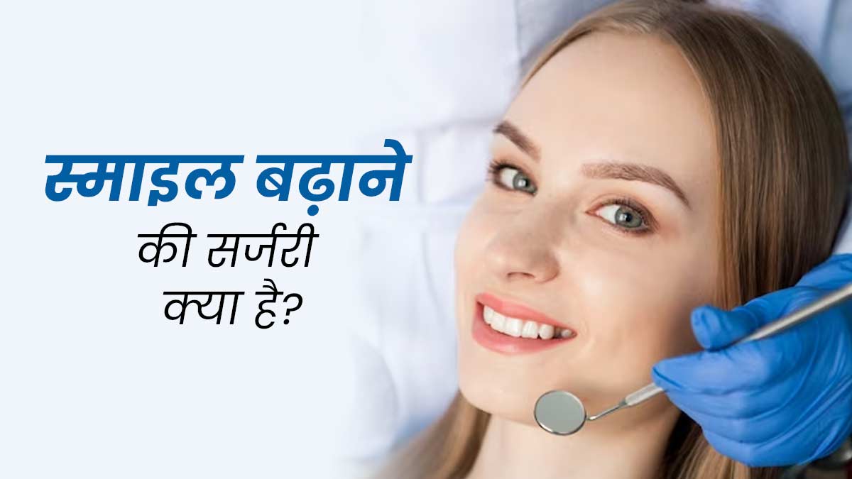 चेहरे की स्माइल ठीक करने के लिए लोग कराते हैं Smile Enlargement Surgery, जानें इसके बारे में